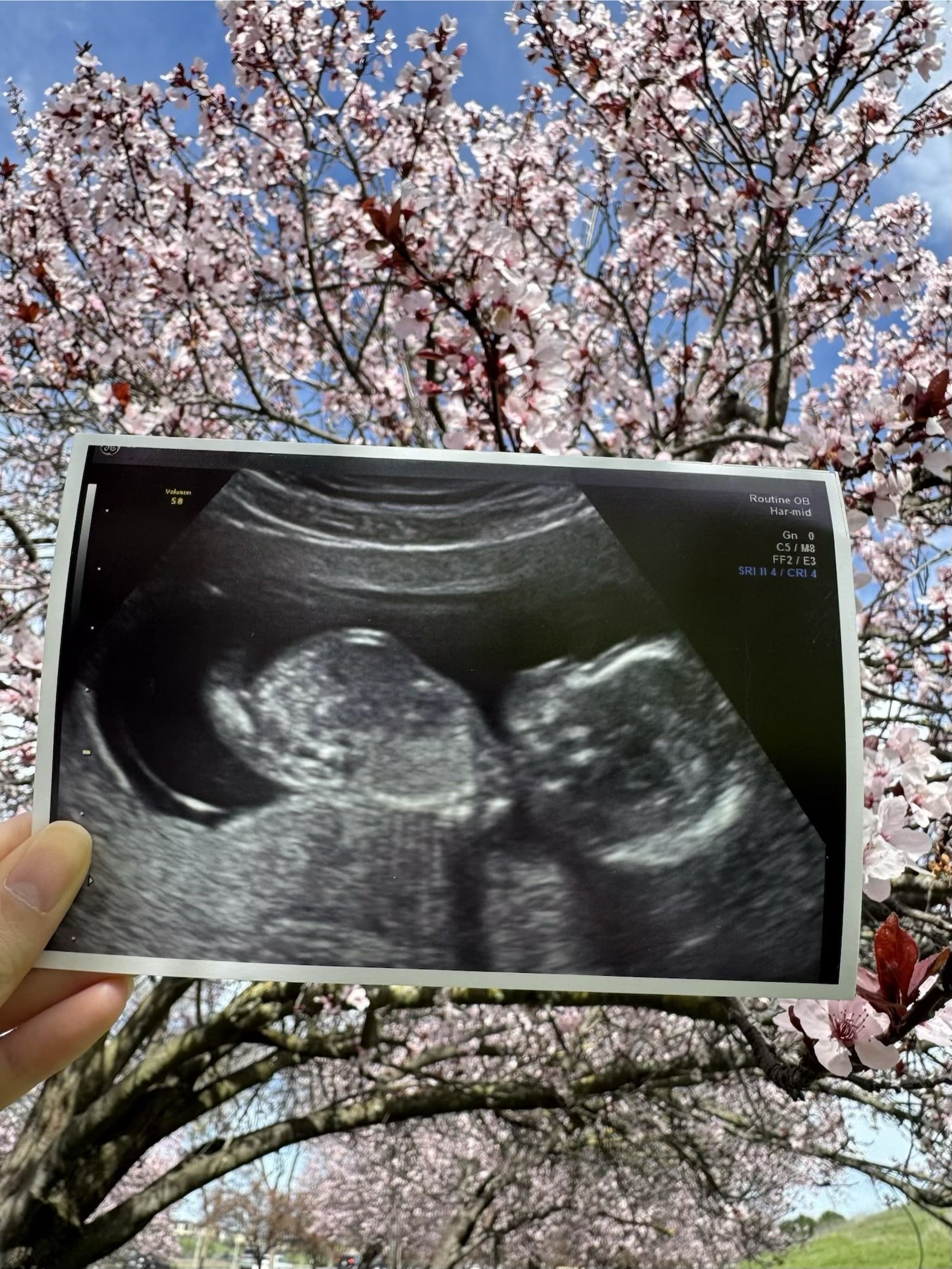 Baby ultrasound beneath cherry blossoms